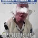 女生遭男友殴打致残 法医不予鉴定的社会之痛，家暴致残法医拒鉴，社会之痛与司法失能