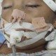 事件回顾，男童术后脑死亡引社会关注，男童术后脑死亡事件引社会广泛关注