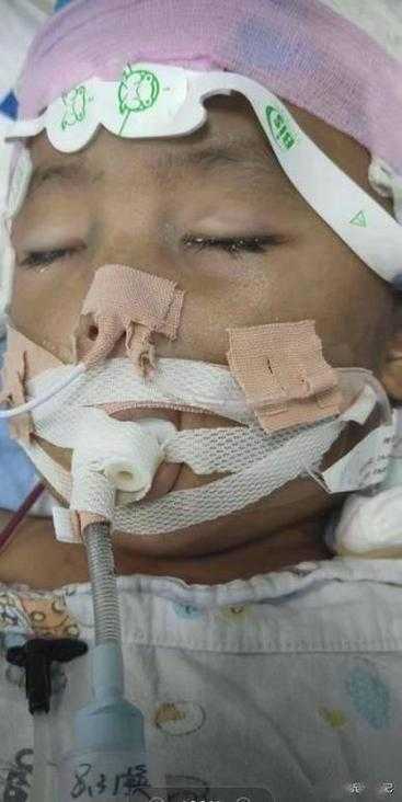 事件回顾，男童术后脑死亡引社会关注